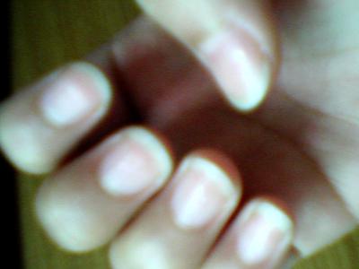 手指甲上有凹凸 手指甲上凸是什么原因?