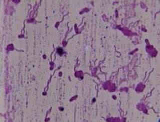 鞭毛和纤毛的区别 鞭毛