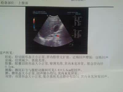 慢性胃炎鉴别诊断 胃炎无法被B超 CT诊断