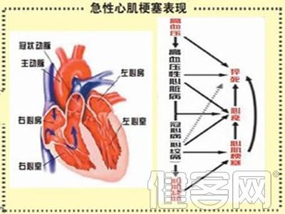 提前预知的情 怎样提前预知中风、心肌梗塞？