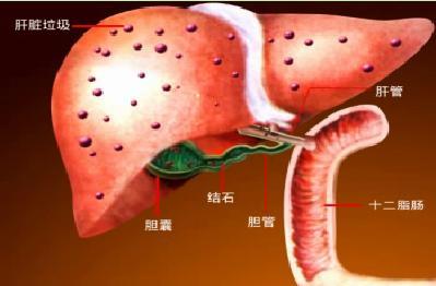 肝脏和胆囊 深层清洁肝脏和胆囊的药草