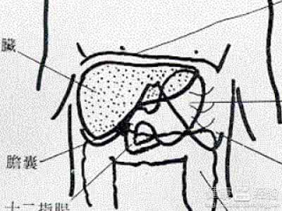 脂肪肝如何消除 如何吃掉脂肪肝