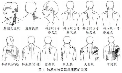 颈椎病康复治疗的方法 颈椎病康复治疗的方法 颈椎病康复治疗的三种方法