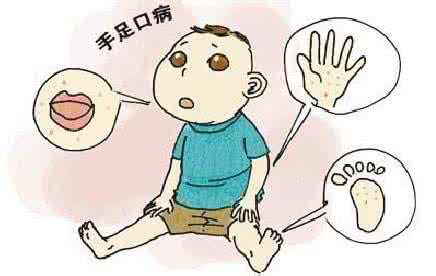 预防手足口病口诀 预防手足口病的七字诀