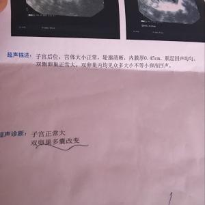 多卵泡和多囊卵巢区别 多卵泡和多囊卵巢区别 多囊卵巢卵泡 多囊卵巢怎么办