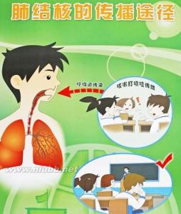 肺结核能彻底治好吗 肺结核的传播途径