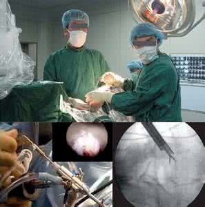 微创手术治疗腰突症 非手术治疗腰突症100例