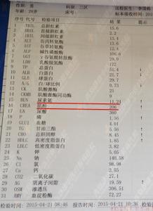 治疗尿毒症的特效秘方 治疗尿毒症的特效秘方，有效率达100%！(韩玉森)