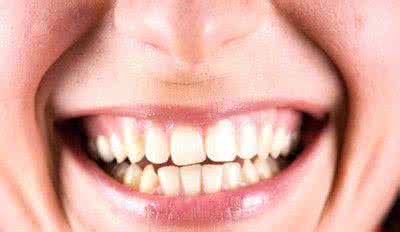 天天刷牙牙齿还是黄 天天刷牙牙齿还是黄 吃完水果马上刷牙 牙齿很受伤