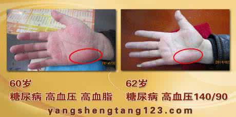 北京养生堂韩学杰视频 养生堂2015年5月29日视频,韩学杰,由表及里话健康3,脑卒中