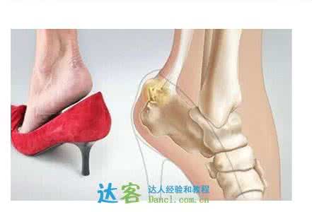 乐福鞋磨脚 乐福鞋前面磨脚怎么办 鞋子前头磨脚怎么办