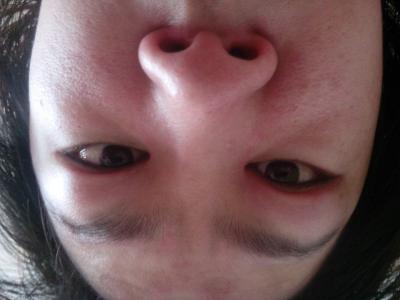 脸肿挂什么科 一侧脸肿 一侧脸肿挂什么科？