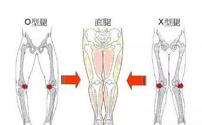 最美的腿型 什么样的腿型最美，腿型不直怎么办(夹紧动作调整腿型)