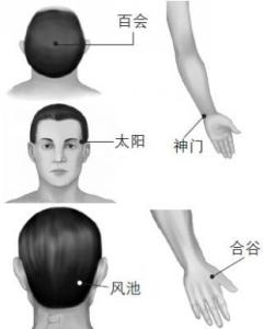 头痛拔罐印堂见效快 治疗头痛的穴位：百会穴、风池穴、印堂穴、太阳穴。