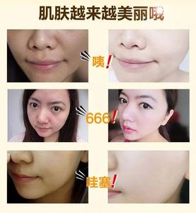 小苏打去黑头步骤 哇2个步骤10分钟去除全部黑头!
