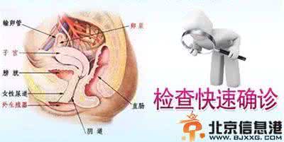 急慢性盆腔炎症状 慢性盆腔炎有什么症状 急慢性盆腔炎的症状及预防