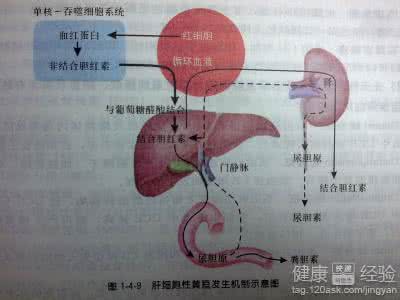 肝细胞性黄疸怎么治疗 肝细胞性黄疸怎么治疗？