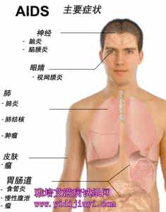 感染艾滋病毒的症状 艾滋病毒检测 身体各大系统常见的艾滋症状