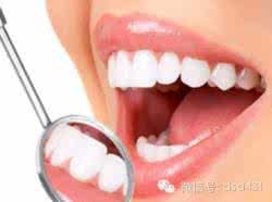 牙保持器哪种好 怎样保持一口“光可鉴人”的好牙