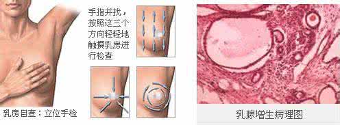 气血调和百病消 乳腺增生要用气血来调和