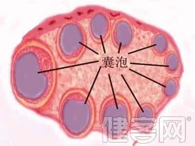 卵巢囊泡是怎么引起的 卵巢囊泡是怎么引起的 卵巢囊泡的表现