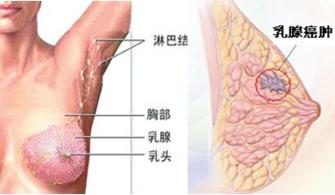 生殖道感染 生殖道感染 解密女性生殖道感染四大误区