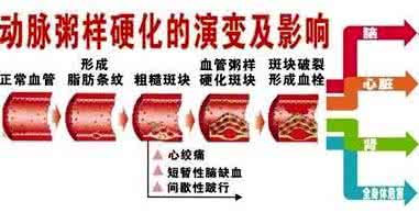 清理血管垃圾的食物 老中医：血管有垃圾易堵塞，常吃这几种碱性食物，干掉血管垃圾,坚持三天，刮油十斤