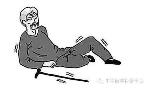 老年人脑出血的原因 老年人臀部着地脑出血