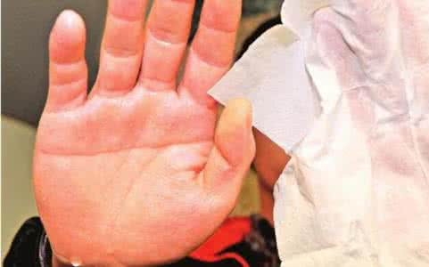手心发热是什么原因 手心发热是怎么回事 了解手心发热的原因