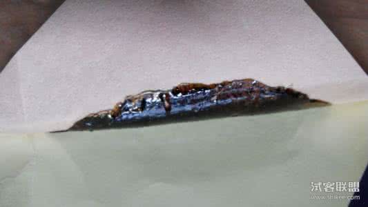 张氏叔侄案案例分析 张氏黑膏药治疗腰椎间盘突出症1344例