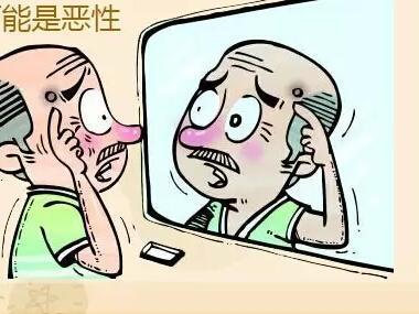 月经前头痛是癌症前兆 癌症的早期信号 小痛或是癌症前兆