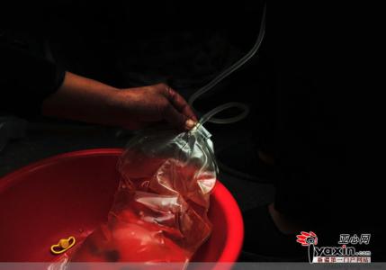 扁桃体肿大民间偏方 【民间偏方】扁桃体发炎,热心把方传!