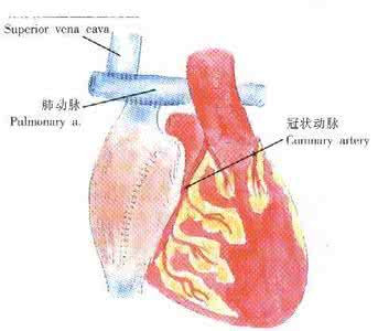 冠状动脉肺动脉瘘 肺动脉瘘能长好么？