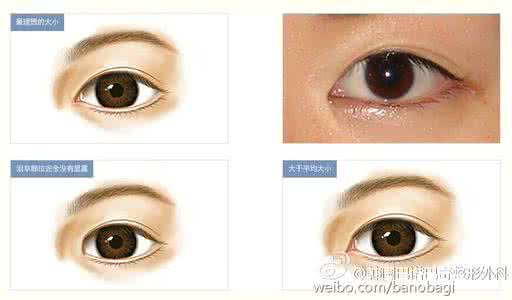 无痕开内眦术 无痕内眦术 无痕开内眦术