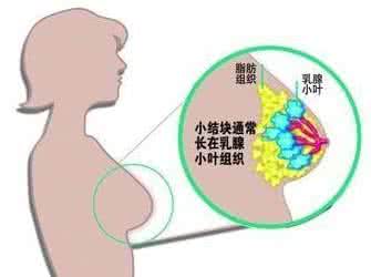 乳腺增生禁忌五种食物 六种日常喜好让乳腺增生远离