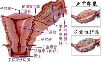 女性卵巢囊肿的治疗 卵巢囊肿的危害 对女性的危害表现