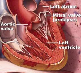 脑血管损伤 脑血管堵塞饮食禁忌 饮食禁忌 吃它一口既损脑又易堵塞血管