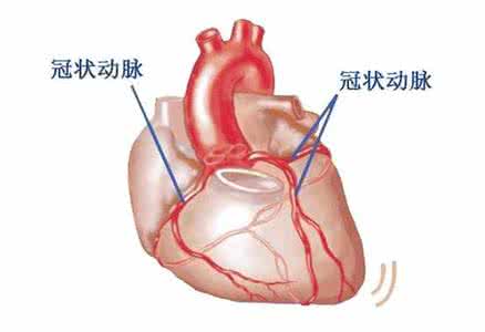 冠心病早期症状 冠心病早期症状 5大身体表现要警惕