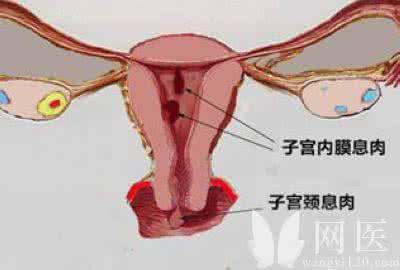 子宫靠后有什么危害 子宫靠下有什么危害 无子宫的危害