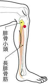 胆结石胆囊炎 膽囊炎、膽結石,不必割掉膽囊,有新發穴位可治。