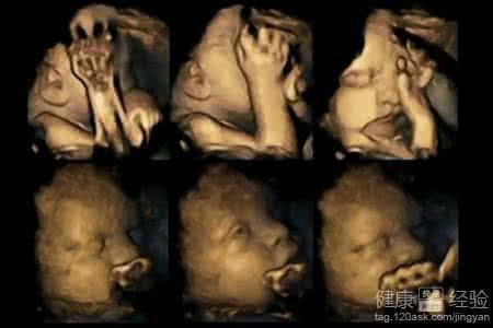 胎儿先天畸形 胎儿先天畸形 【吸烟对胎儿的影响】孕妇吸烟增加胎儿先天畸形概率