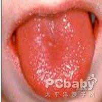 舌苔厚白是怎么回事 舌苔厚白是怎么回事 舌苔厚白的体征反应