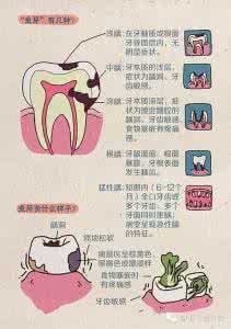 虫牙怎么治疗小妙招 预防虫牙 虫牙怎么治 如何预防虫牙