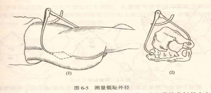 如何测量骨盆大小 骨盆测量 骨盆测量 如何进行骨盆测量