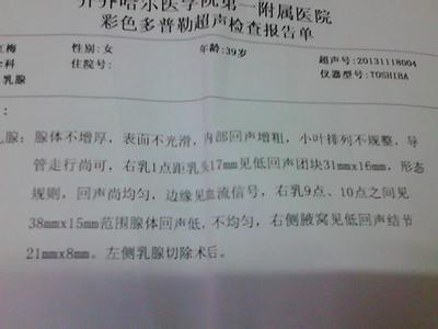 严重贫血的症状 严重贫血的症状 严重贫血的表现是什么