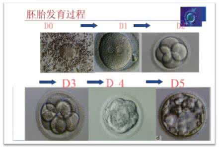 试管婴儿培养囊胚 试管婴儿培养囊胚 根据囊胚培养利弊做出的决策