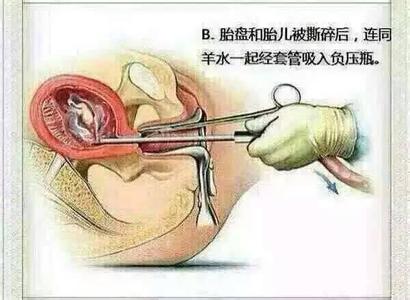 器官衰竭还能恢复吗 你怎么继续过好日子；身体器官还能使用多久，你知道吗？