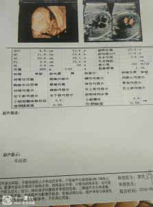 唐氏筛查和四维彩超 四维彩超能排除唐氏 四维彩超能排除唐氏？四维彩超与唐氏筛查的区别