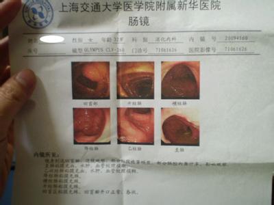 慢性肠炎鉴别诊断 你知道如何诊断慢性肠炎吗