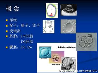 辅助生殖技术 辅助生殖技术 辅助生殖的衍生技术之—精子